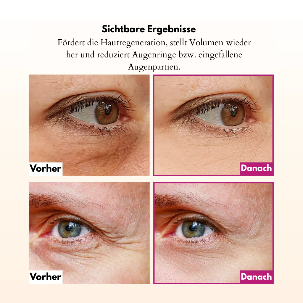 Anti-Falten & Volumen-Stick Duo