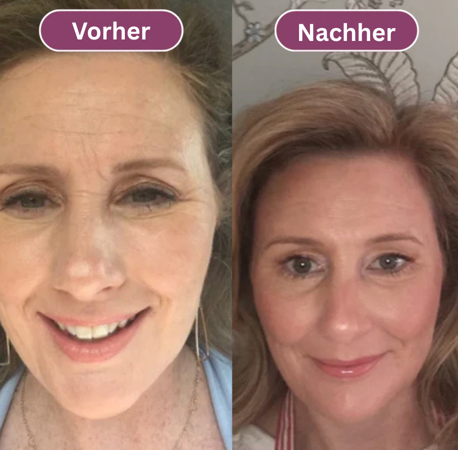 Anti-Falten & Volumen-Stick Duo