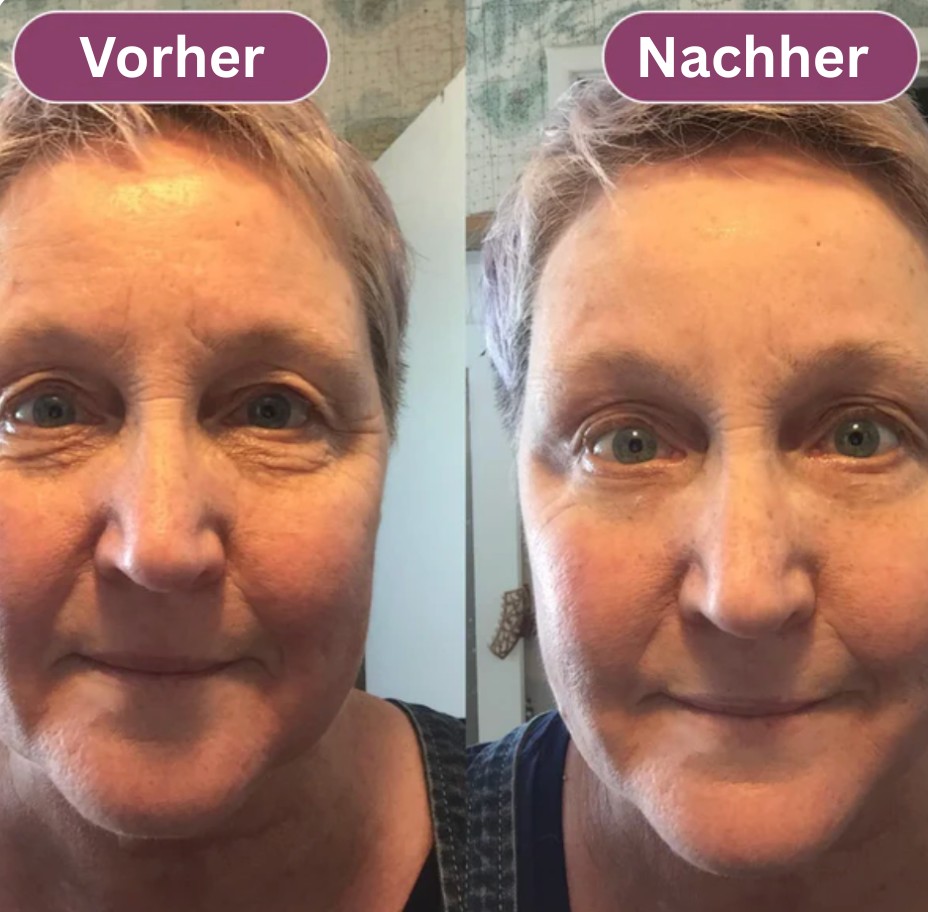 Anti-Falten & Volumen-Stick Duo